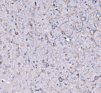 Anti-FXR1 Antibody