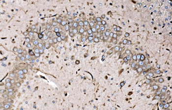 Anti-FXR1 Antibody