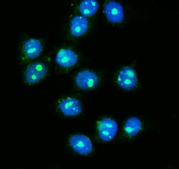 NOLA1/GAR1 Antibody