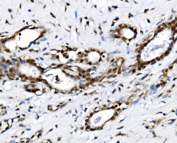 Anti-NOLA1/GAR1 Antibody