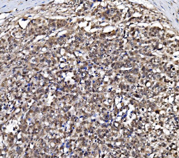 Anti-NOLA1/GAR1 Antibody