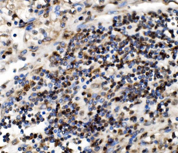 Anti-NOLA1/GAR1 Antibody