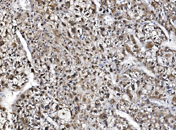 Anti-NOLA1/GAR1 Antibody