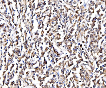 Anti-NOLA1/GAR1 Antibody