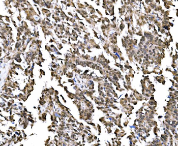 Anti-NOLA1/GAR1 Antibody