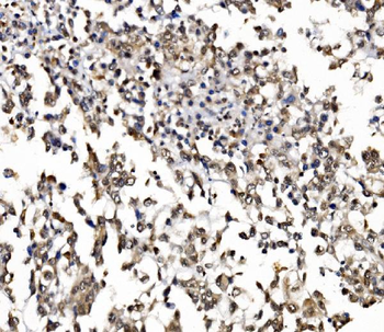 Anti-NOLA1/GAR1 Antibody