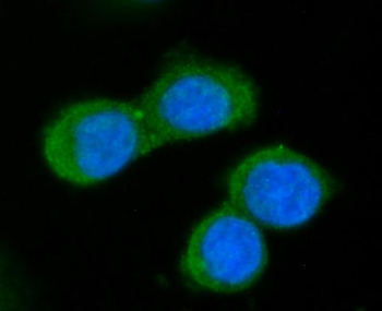 Anti-GGCX Antibody