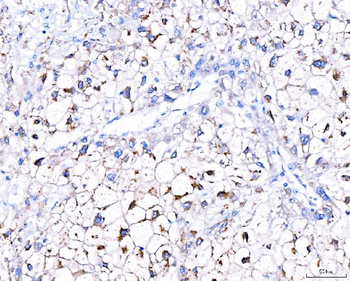 Anti-GGCX Antibody