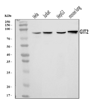 Anti-GIT2 Antibody