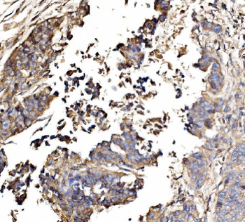 Anti-GNAL Antibody