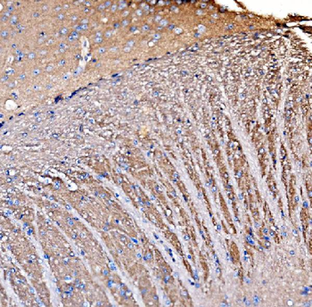 Anti-GNAL Antibody
