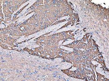 Anti-GNAL Antibody