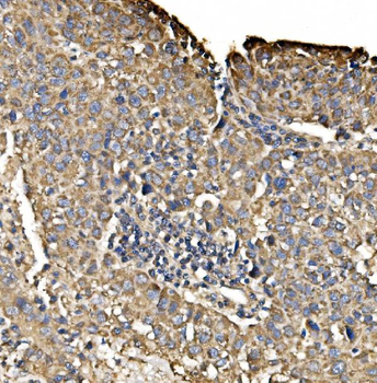 Anti-PIST/GOPC Antibody