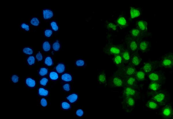 Anti-GTF2F2 Antibody