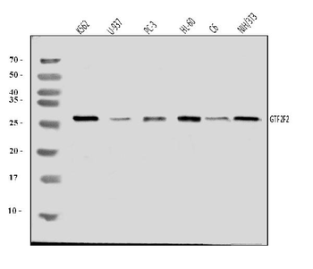Anti-GTF2F2 Antibody