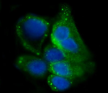 Anti-Glycogen synthase 1/GYS1 Antibody