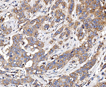 Anti-Glycogen synthase 1/GYS1 Antibody