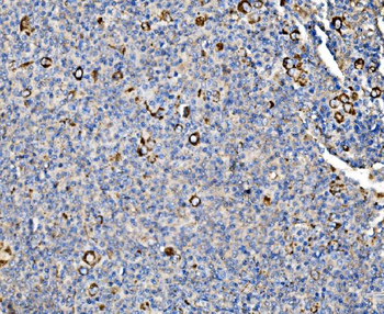 Anti-Glycogen synthase 1/GYS1 Antibody