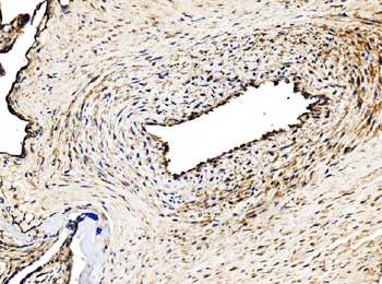 Anti-Glycogen synthase 1/GYS1 Antibody