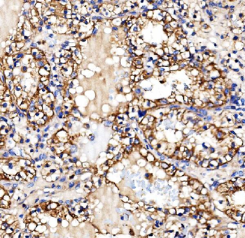 Anti-Glycogen synthase 1/GYS1 Antibody