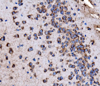 Anti-Glycogen synthase 1/GYS1 Antibody