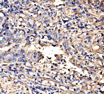 Anti-HECTD1 Antibody