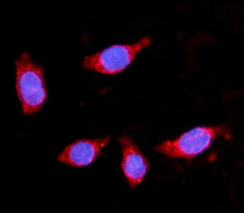 Anti-HMGCS2 Antibody