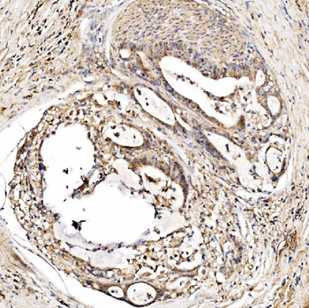 Anti-HMGCS2 Antibody