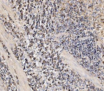 Anti-HMGCS2 Antibody