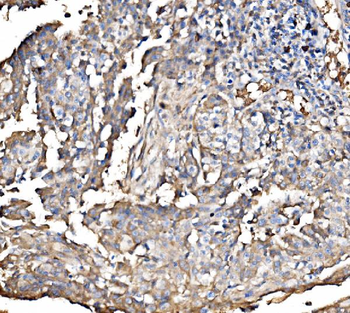 Anti-HMGCS2 Antibody