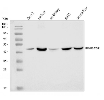 Anti-HMGCS2 Antibody