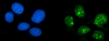 Anti-HPD Antibody
