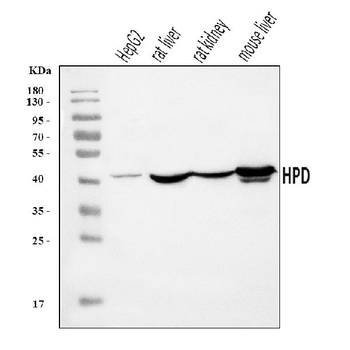 Anti-HPD Antibody