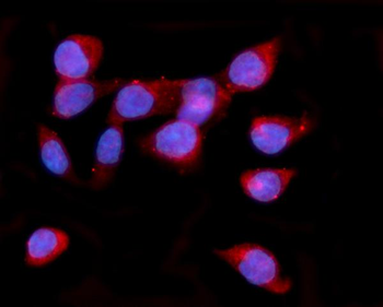 Anti-ORP150/HYOU1 Antibody