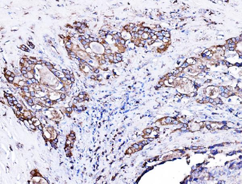 Anti-ORP150/HYOU1 Antibody