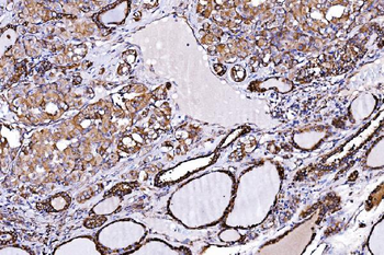 Anti-ORP150/HYOU1 Antibody