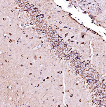 Anti-ORP150/HYOU1 Antibody