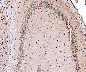 Anti-ORP150/HYOU1 Antibody