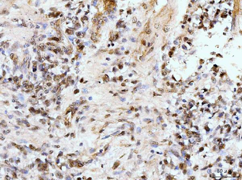 Anti-IFI16 Antibody