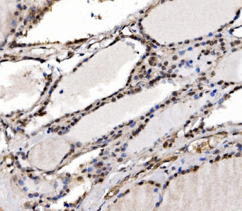 Anti-IFI16 Antibody