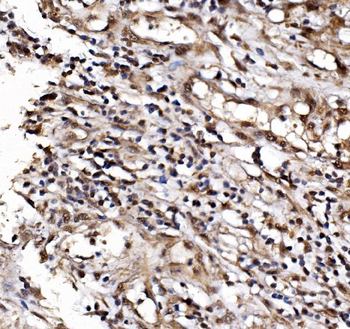 Anti-IFI16 Antibody