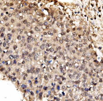 Anti-IFI16 Antibody