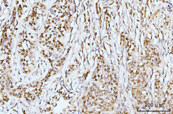 Anti-IFI16 Antibody