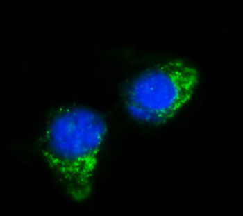 Anti-IFIT5 Antibody