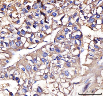 Anti-IFIT5 Antibody