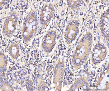 Anti-IFIT5 Antibody
