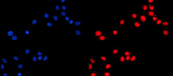 KIF4A/4B Antibody