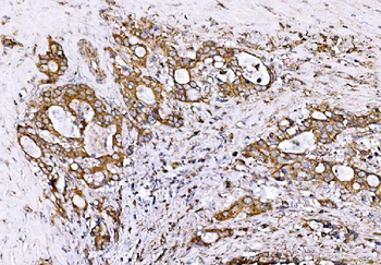 Anti-GPR54/KISS1R Antibody