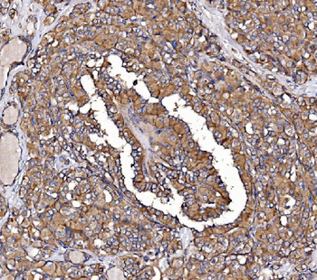 Anti-GPR54/KISS1R Antibody