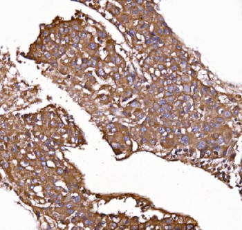 Anti-GPR54/KISS1R Antibody